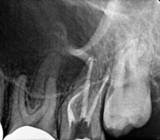 x-ray