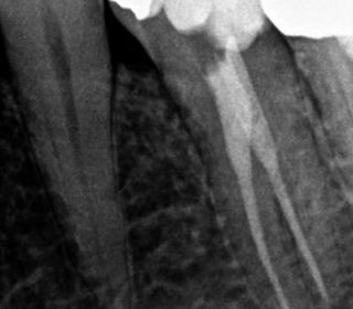 x-ray