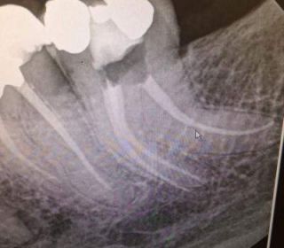 x-ray