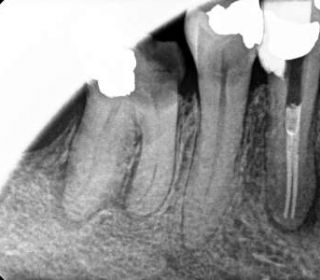 xray